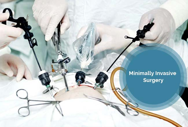 Minimally Invasive Procedures in Indore