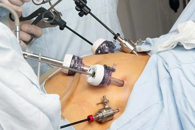Minimally Invasive Procedures in Indore