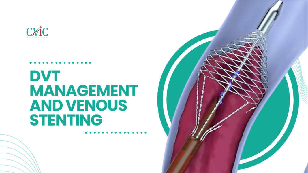 DVT Management and venous stenting