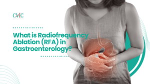 What is Radiofrequency Ablation (RFA) in Gastroenterology?