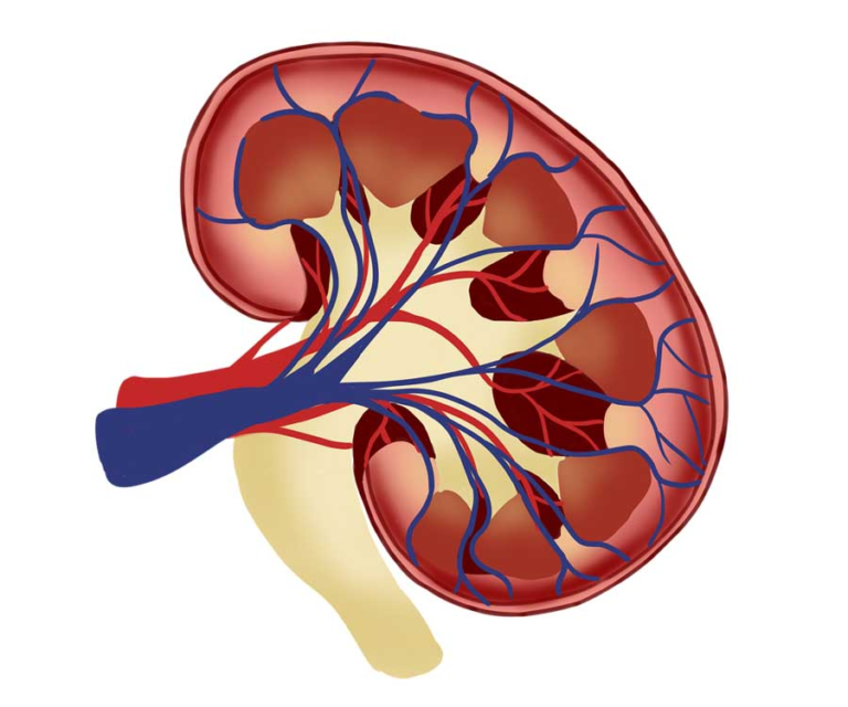 Stents Rinones How successful are renal artery stents?