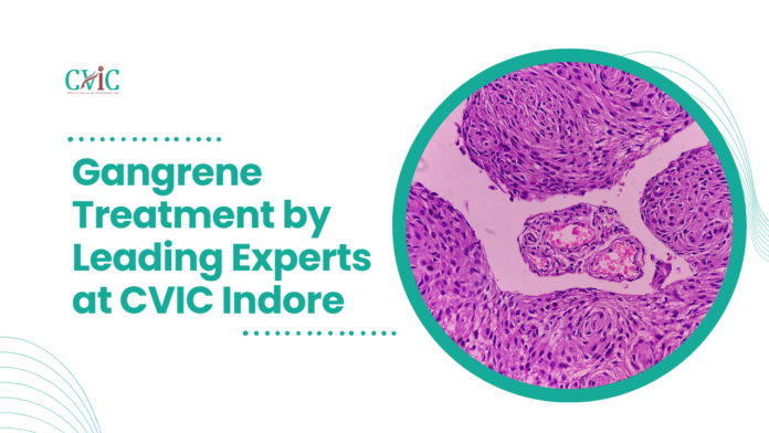 Gangrene treatment at CVIC by Dr. Shailesh Gupta, Dr. Alok Kumar Udiya, Dr. Nishant Bhargava