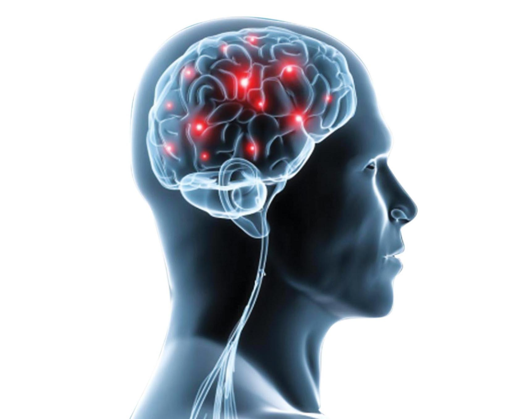 Top Neuro Doctors in Indore