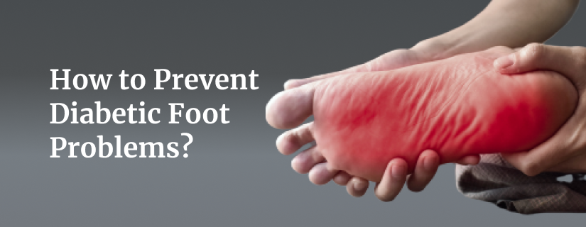 How to prevent diabetic foot problems with proper care and management.