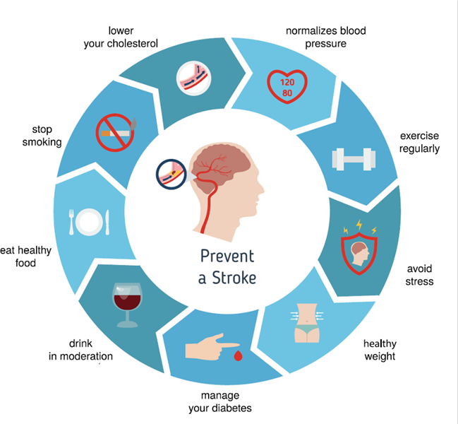 Lifestyle changes after a stroke for better health and recovery