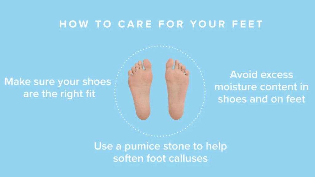 How to prevent diabetic foot problems with proper care and management.