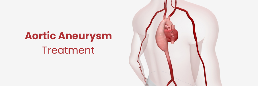 Best treatment options for an aneurysm explained through modern medical practices.