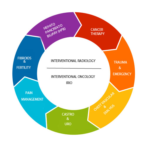 What Are the Benefits of Interventional Radiology?