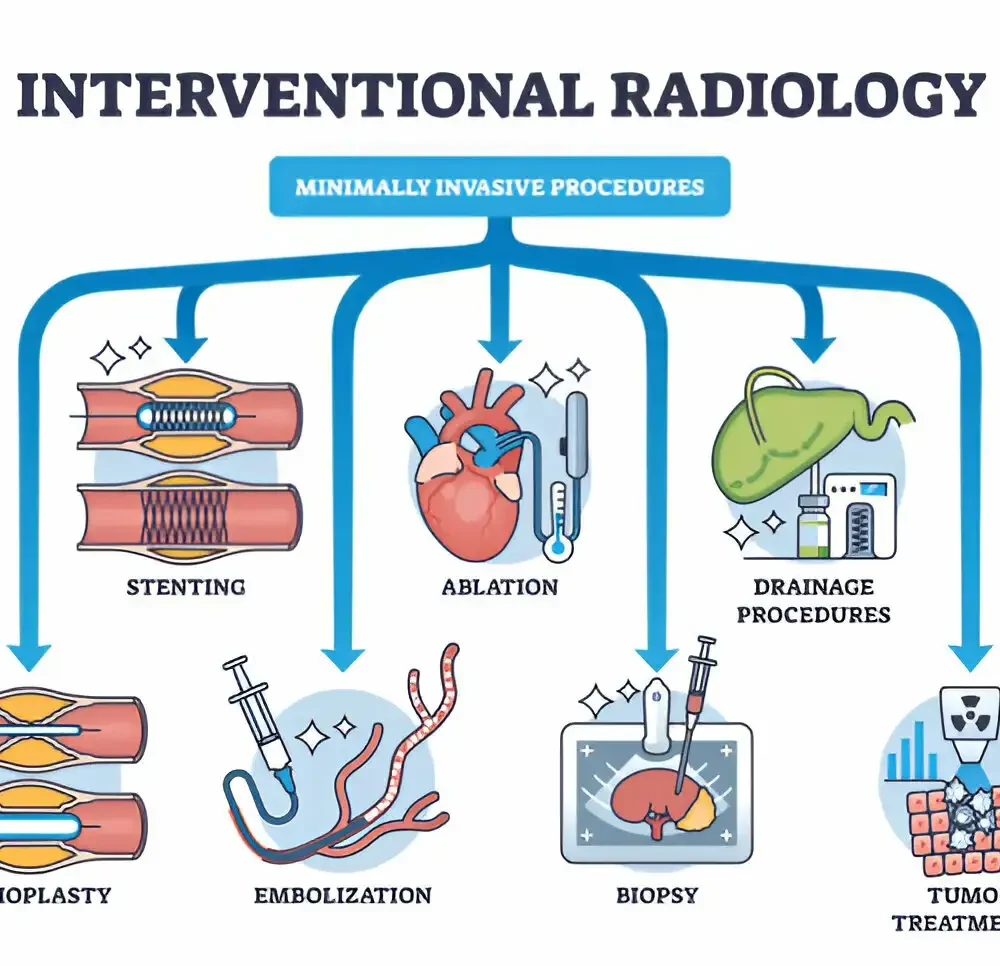 What Are the Benefits of Interventional Radiology?