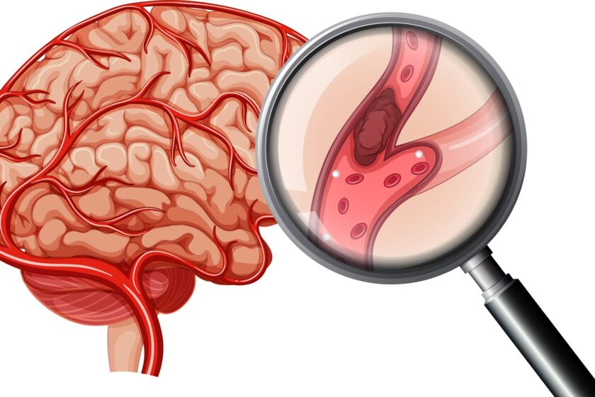 What conditions does an endovascular surgeon treat