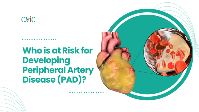 Who is at Risk for Developing Peripheral Artery Disease (PAD)?