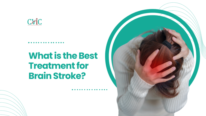 What is the Best Treatment for Brain Stroke