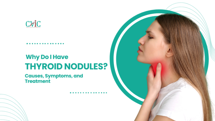 Thyroid Nodules