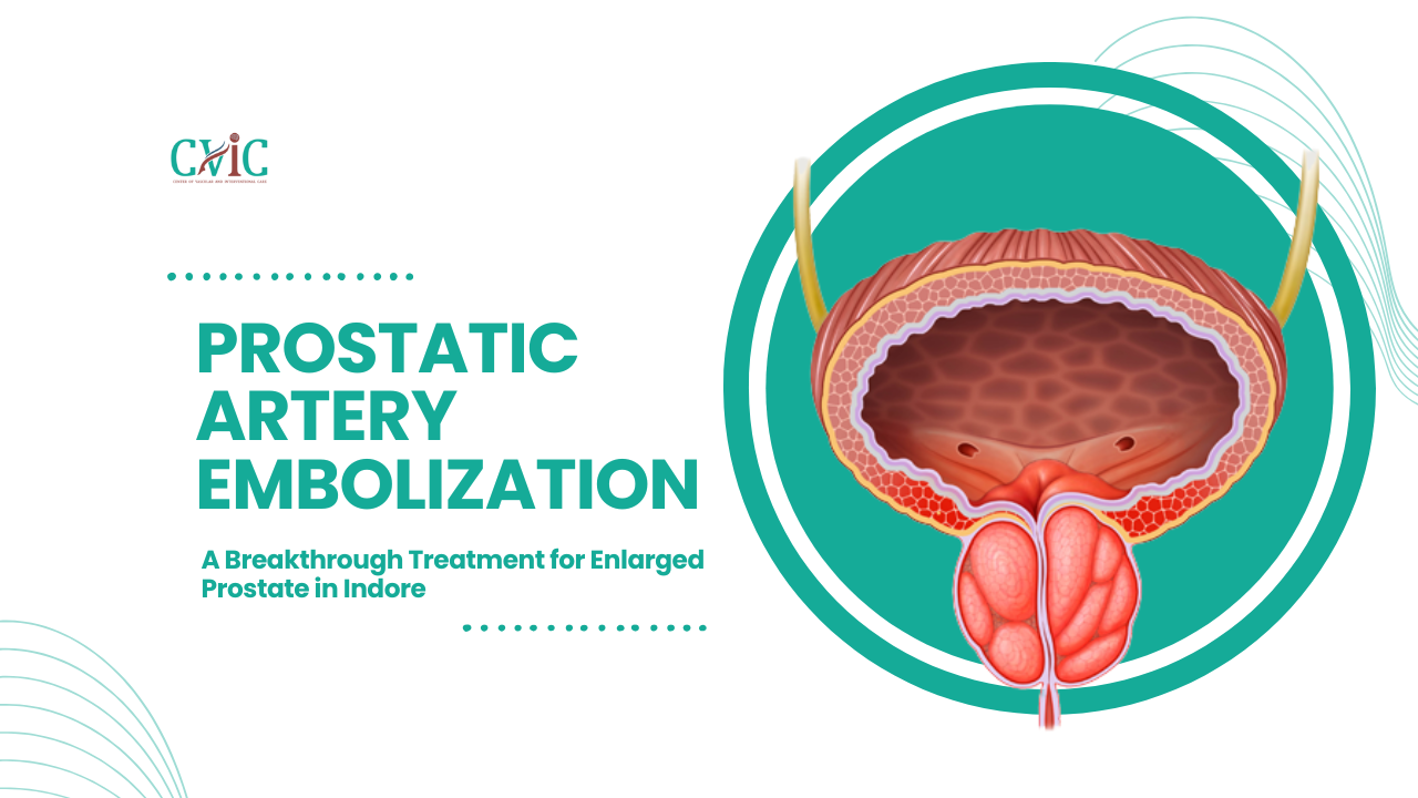 Prostatic Artery Embolization: A Breakthrough Treatment for Enlarged Prostate in Indore