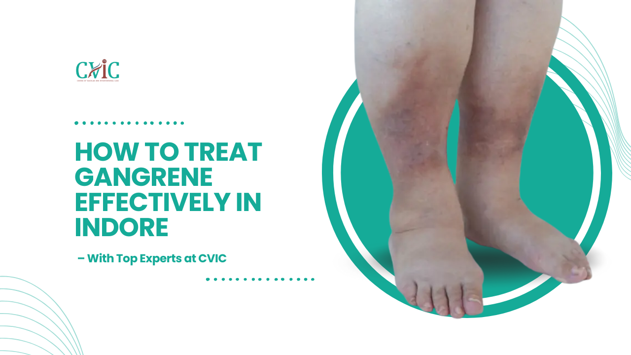 How to Treat Gangrene Effectively in Indore – With Top Experts at CVIC