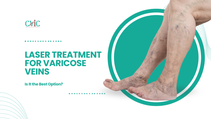 Laser Treatment