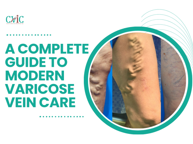 VenaSeal Treatment: A Complete Guide to Modern Varicose Vein Care
