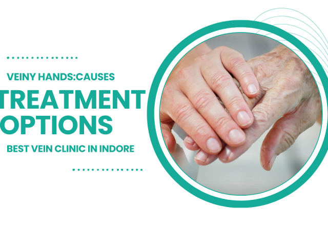 Veiny Hands: Causes, Treatments, and When to See a Doctor