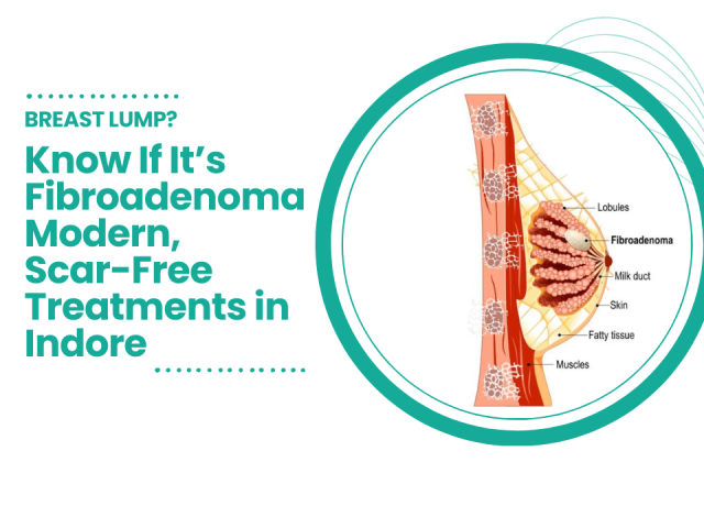 Breast Fibroadenoma: Symptoms, Diagnosis, and Best Treatment in Indore