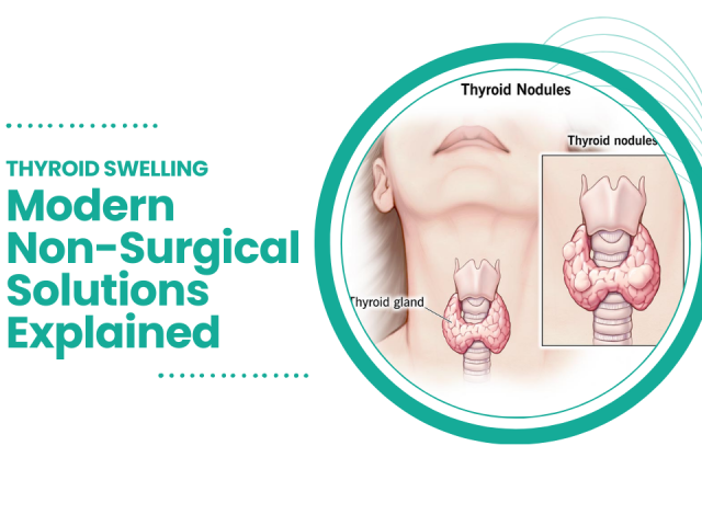 Thyroid Health: Treating Hypothyroidism, Goiters, and Thyroid Nodules