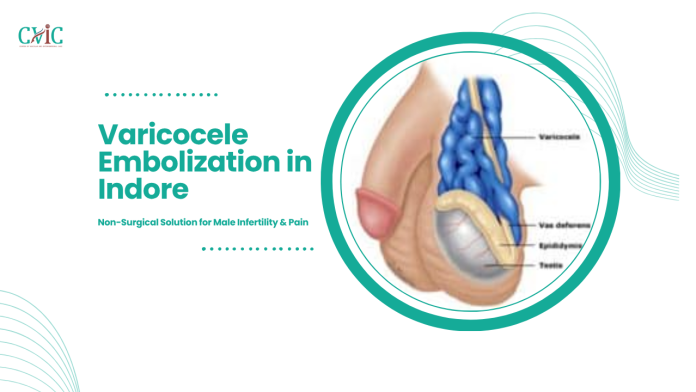 Varicocele Embolization in Indore