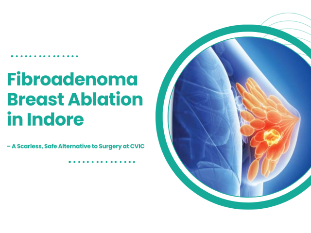 Fibroadenoma Breast Ablation in Indore – A Scarless, Safe Alternative to Surgery at CVIC