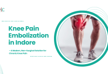 Knee Pain Embolization in Indore – A Modern, Non-Surgical Solution for Chronic Knee Pain Knee Pain Embolization in Indore