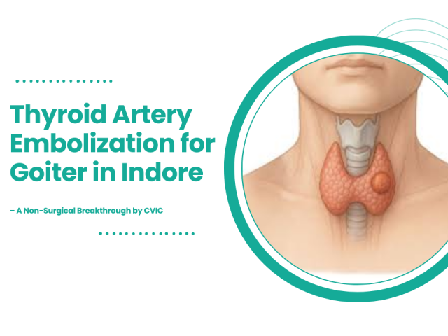 Thyroid Artery Embolization for Goiter in Indore – A Non-Surgical Breakthrough by CVIC