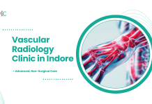 Vascular Radiology Clinic in Indore: Advanced, Non-Surgical Care | CVIC Indore vascular radiology clinic in indore