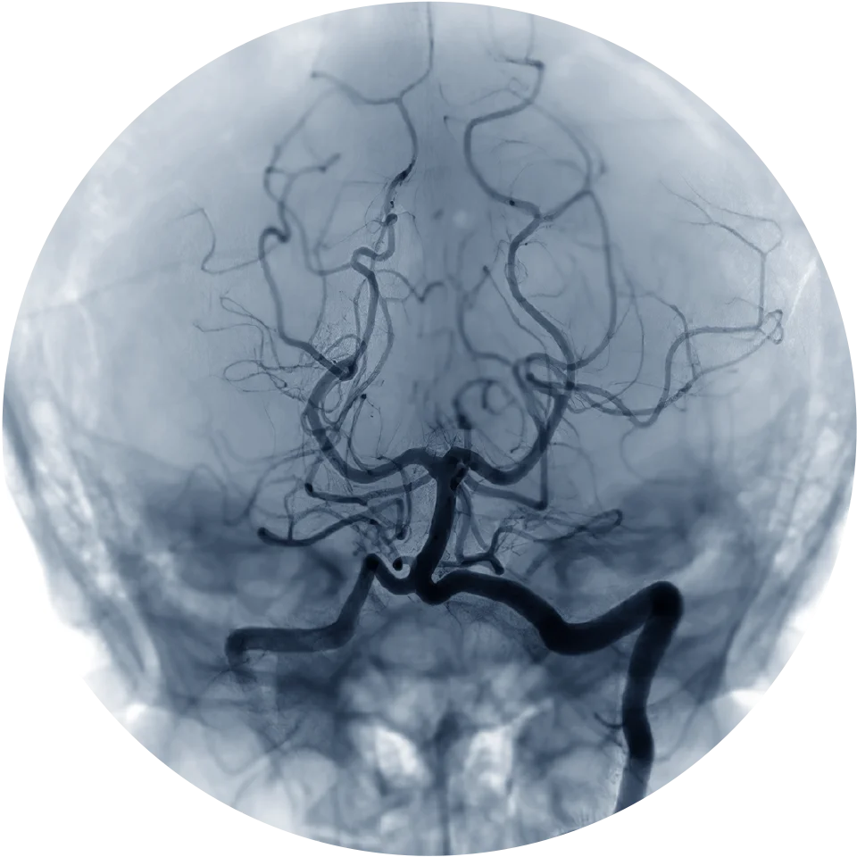 Vascular Radiology Clinic in Indore