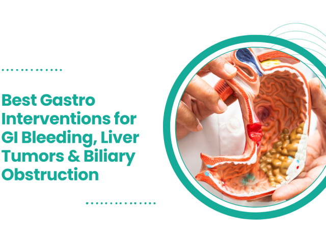 Best Gastro Interventions for GI Bleeding, Liver Tumors & Biliary Obstruction