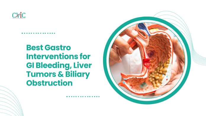 Best Gastro Interventions Best Gastro Interventions