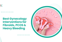Best Gynecology Interventions for Fibroids, PCOS & Heavy Bleeding Best Gynecology