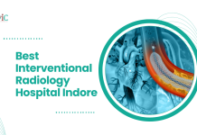 Best Interventional Radiology Hospital Indore | CVIC Indore Best Interventional Radiology Hospital Indore