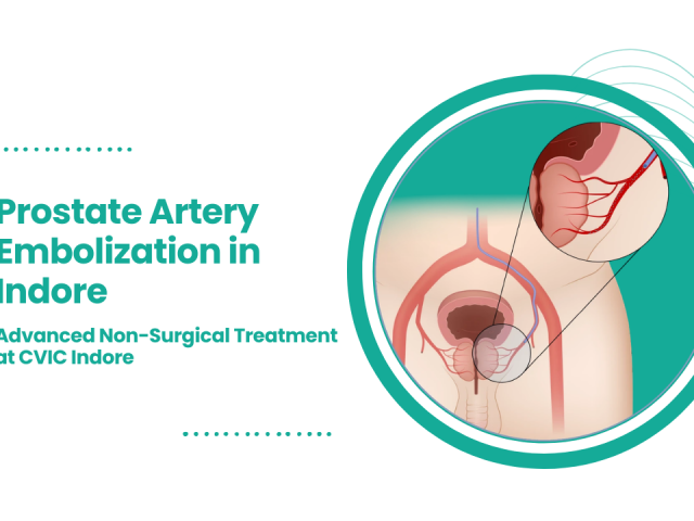 Prostate Artery Embolization in Indore: Advanced Non-Surgical Treatment at CVIC Indore