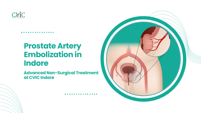 Prostate Artery Embolization in Indore Prostate Artery Embolization in Indore