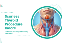 Scarless Thyroid Procedure Indore | A Modern, Non-Surgical Solution by CVIC Indore Scarless Thyroid Procedure Indore