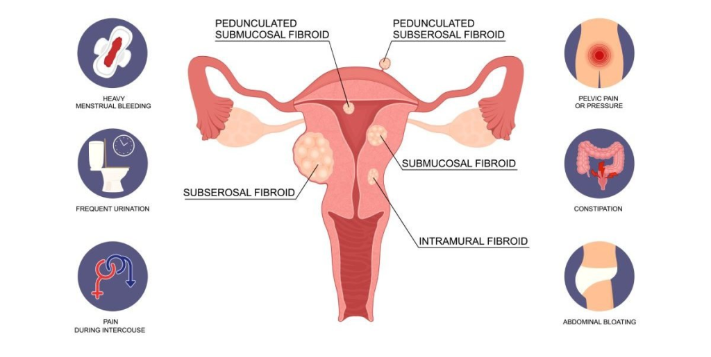 Best Gynecology