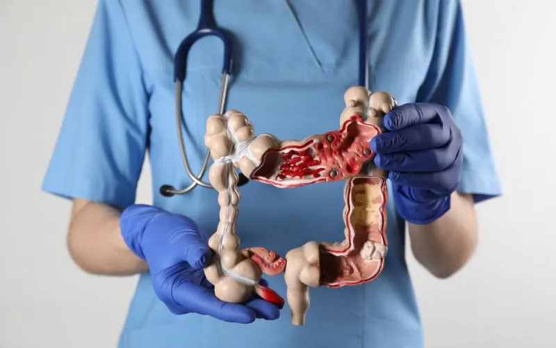 When to Visit a Gastro Doctor