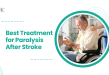 Best Treatment for Paralysis After Stroke | CVIC Indore Treatment for Paralysis After Stroke