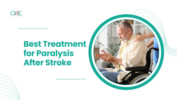 Best Treatment for Paralysis After Stroke Treatment for Paralysis After Stroke