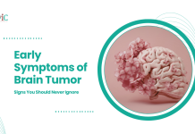 Early Symptoms of Brain Tumor: Signs You Should Never Ignore | CVIC Indore Symptoms of Brain Tumor