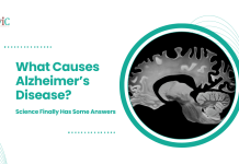 What Causes Alzheimer’s Disease? Science Finally Has Some Answers Alzheimer’s Disease