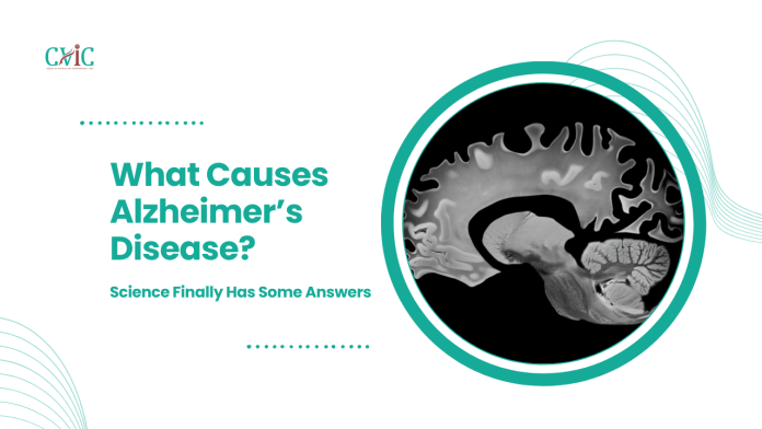 Alzheimer’s Disease