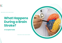 What Happens During a Brain Stroke? A Complete Guide What Happens During a Brain Stroke
