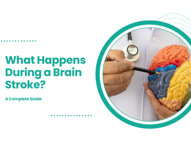 What Happens During a Brain Stroke? A Complete Guide