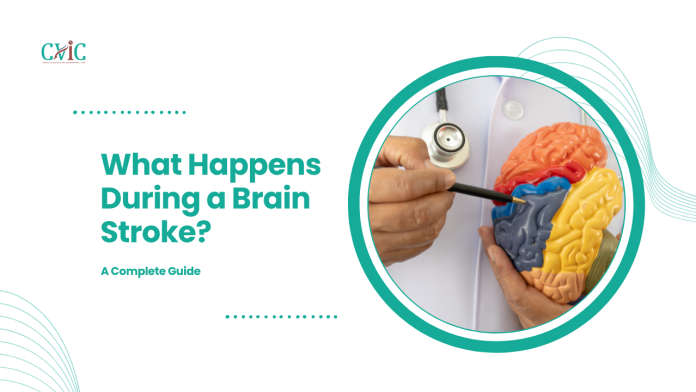What Happens During a Brain Stroke