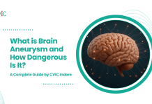 What is Brain Aneurysm and How Dangerous Is It? A Complete Guide by CVIC Indore Brain Aneurysm
