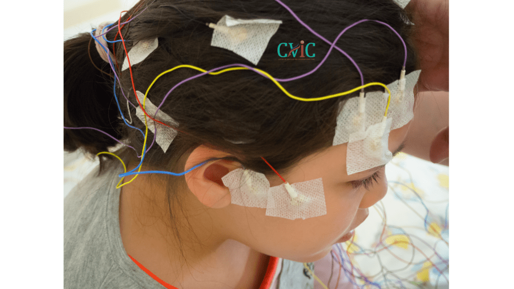Causes of Epilepsy
