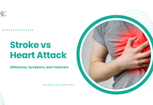 Stroke vs Heart Attack: Differences, Symptoms, and Treatment | CVIC Indore Stroke vs Heart Attack